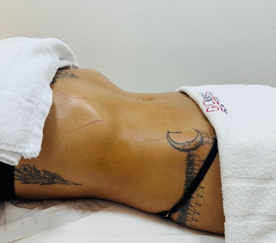 Massagens Terapêuticas